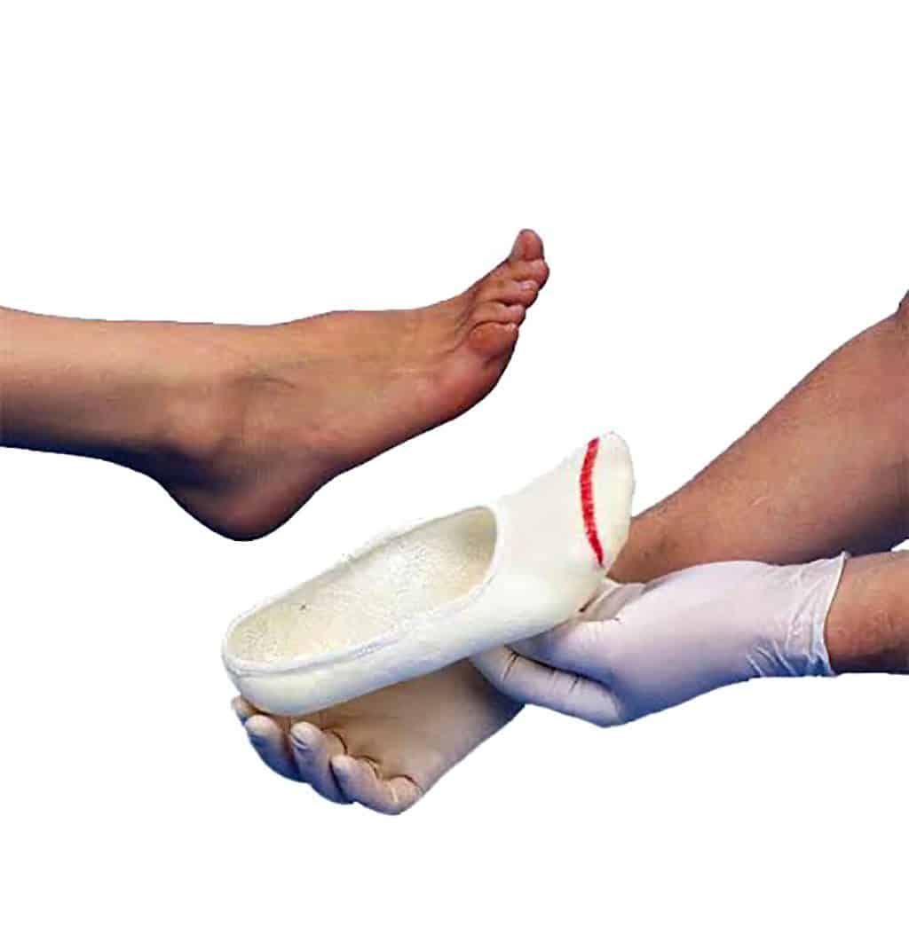 Leg cast application on a patient's foot by medical professional